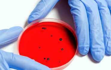 Vaiolo delle scimmie